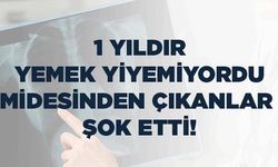 1 Yıldır Yemek Yiyemeyen Adamın Midesinden Çıkanlar Şok Etti