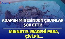 Adamın Midesinden Çıkanlar Hayret Ettirdi! Mıknatıs, Madeni Para, Çivi, Pil...