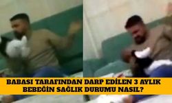 Babası Tarafından Darp Edilen 3 Aylık Bebeğin Durumu Nasıl, Gelişme Var Mı?