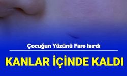 Fare Saldırısı: Çocuğun Yüzünü Isırarak Kanlar İçinde Bıraktı