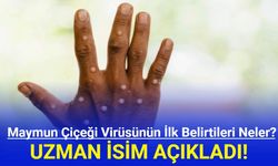 Maymun çiçeği hastalığının ilk belirtilerini uzman isim açıkladı!