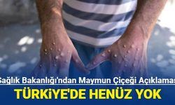 Maymun çiçeği Türkiye'de görüldü mü? Bakanlık açıkladı