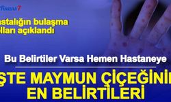 Maymun Çiçeği Virüsü Belirtileri ve Bulaşma Yolları Açıklandı